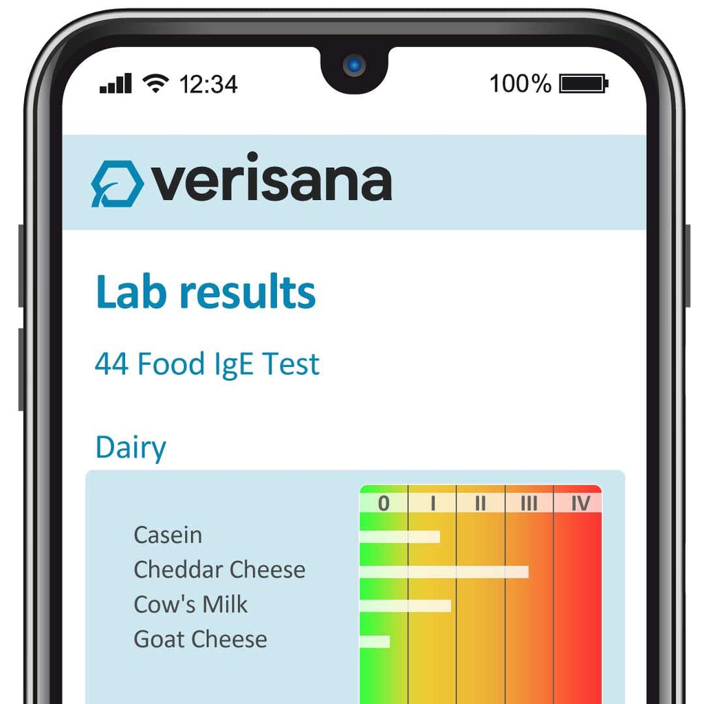 Food Allergy Test 44 Foods E5600